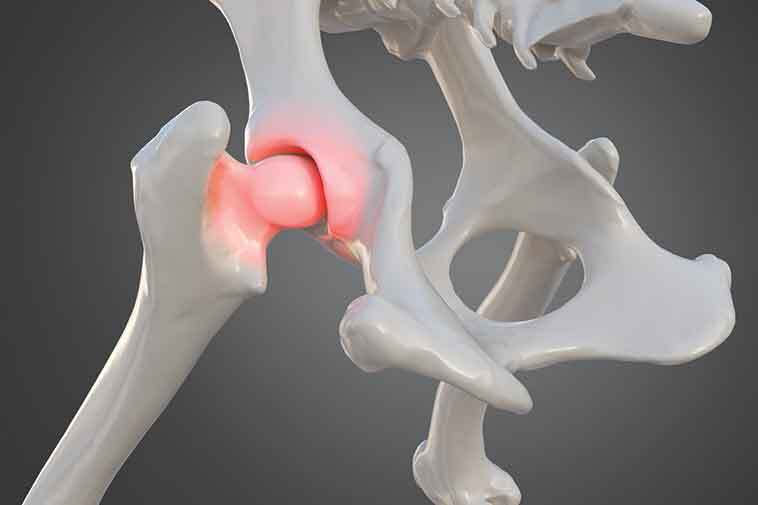 displasia nei cani immagine dell'anca